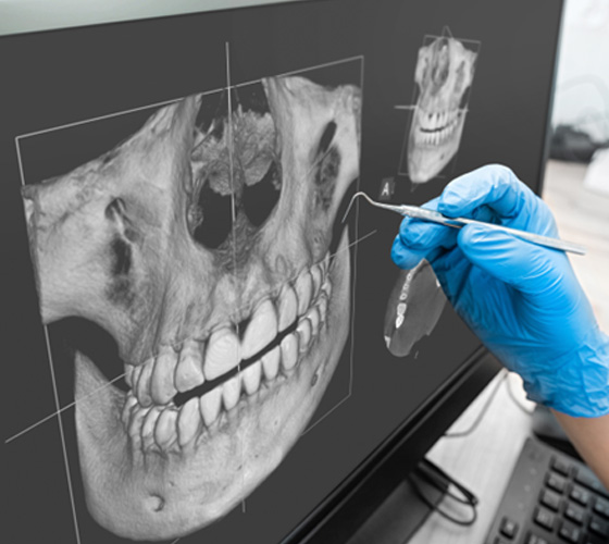 a dentist pointing at an image of a mouth